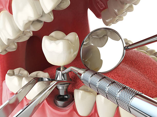 Best Emergency TMJ Treatment in Warr Acres, OK