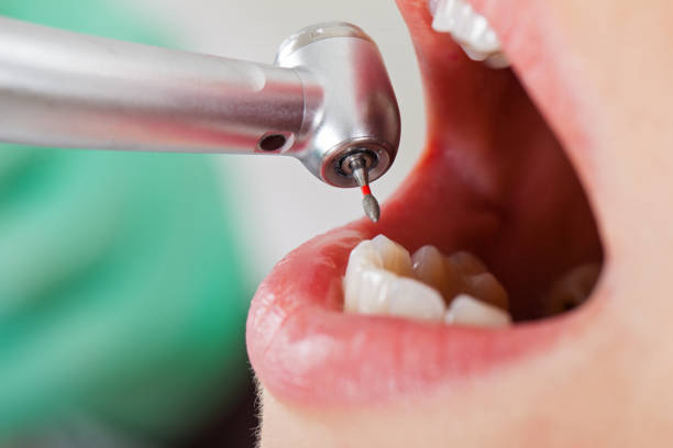 Best Emergency Treatment for Dental Infections or Abscesses in Warr Acres, OK